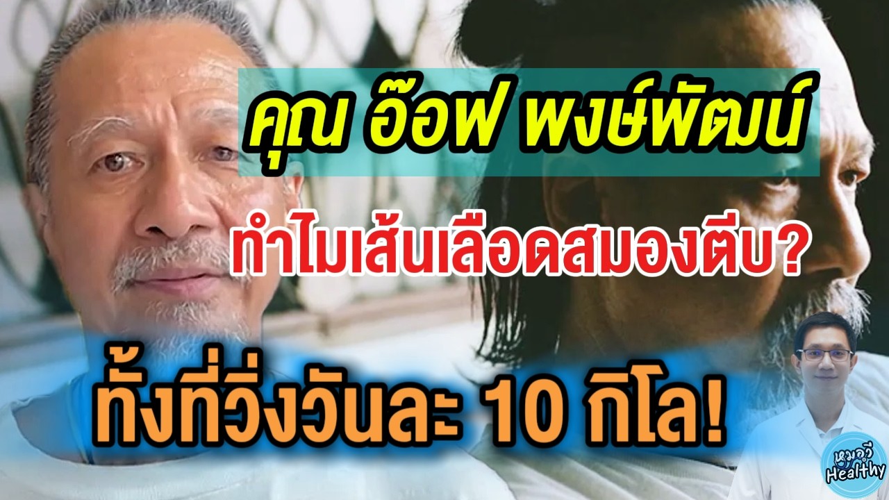 90% ของโรคอัมพฤกษ์ - อัมพาต สามารถป้องกันได้จาก 5 วิธีนี้ | หมอวี รอบโรคกับคนดัง
