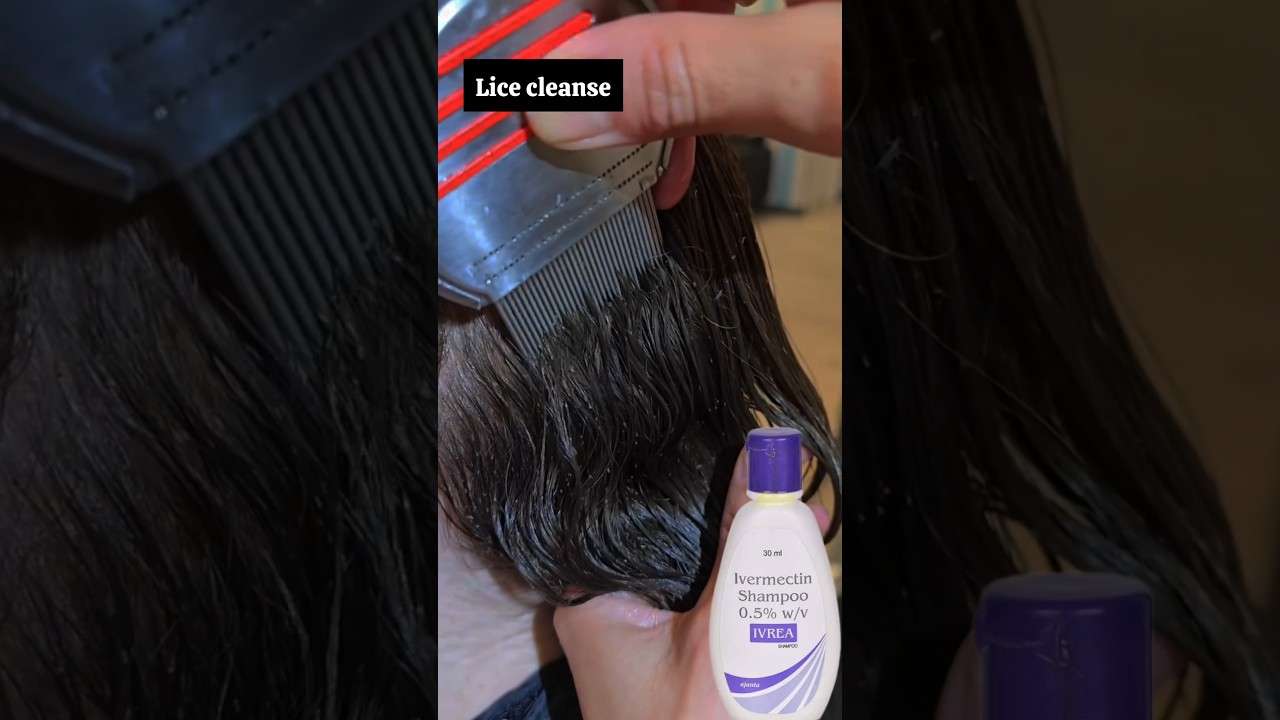 Lice & nits treatment | Best Lice Comb for Easy Removal! 🪮✨  #liceremoval #licetreatment#piojos