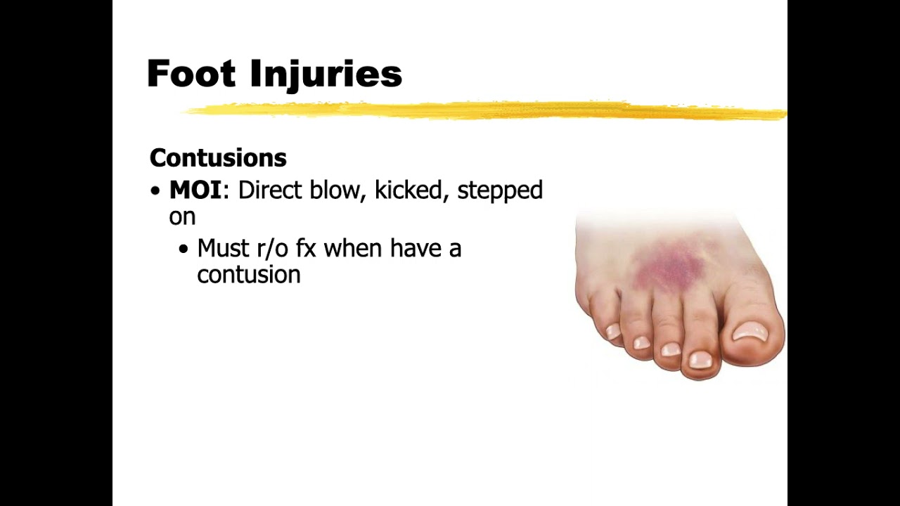 Foot Injuries