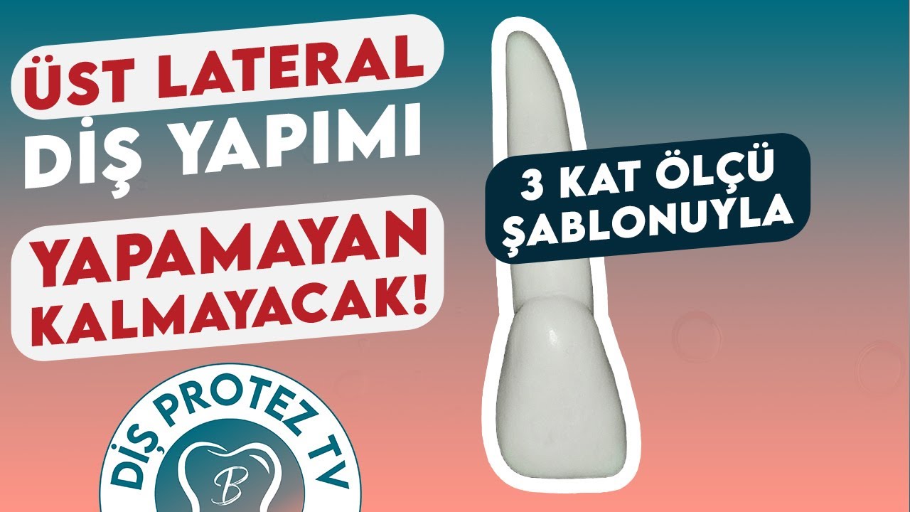 Üst Lateral Diş Yapımı | Maxillary Lateral Incisor | Diş Morfolojisi