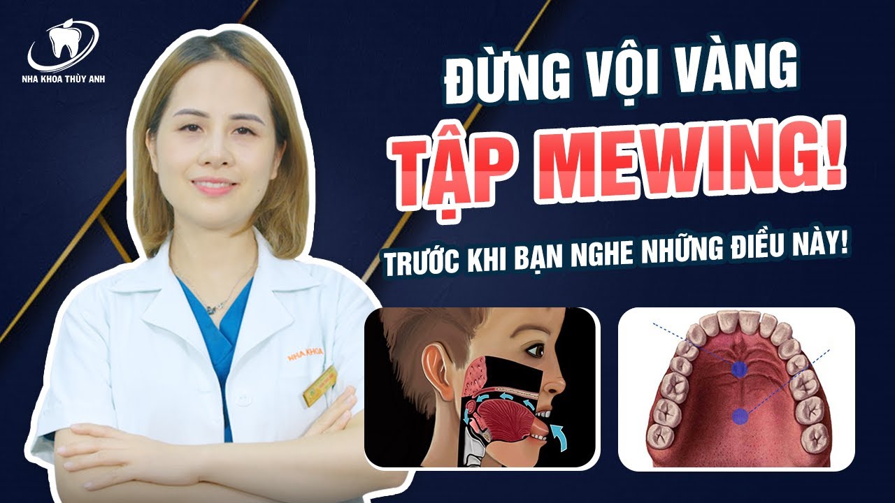 5 Sai lầm cơ bản khi tập Mewing khiến kết quả không như mong đợi