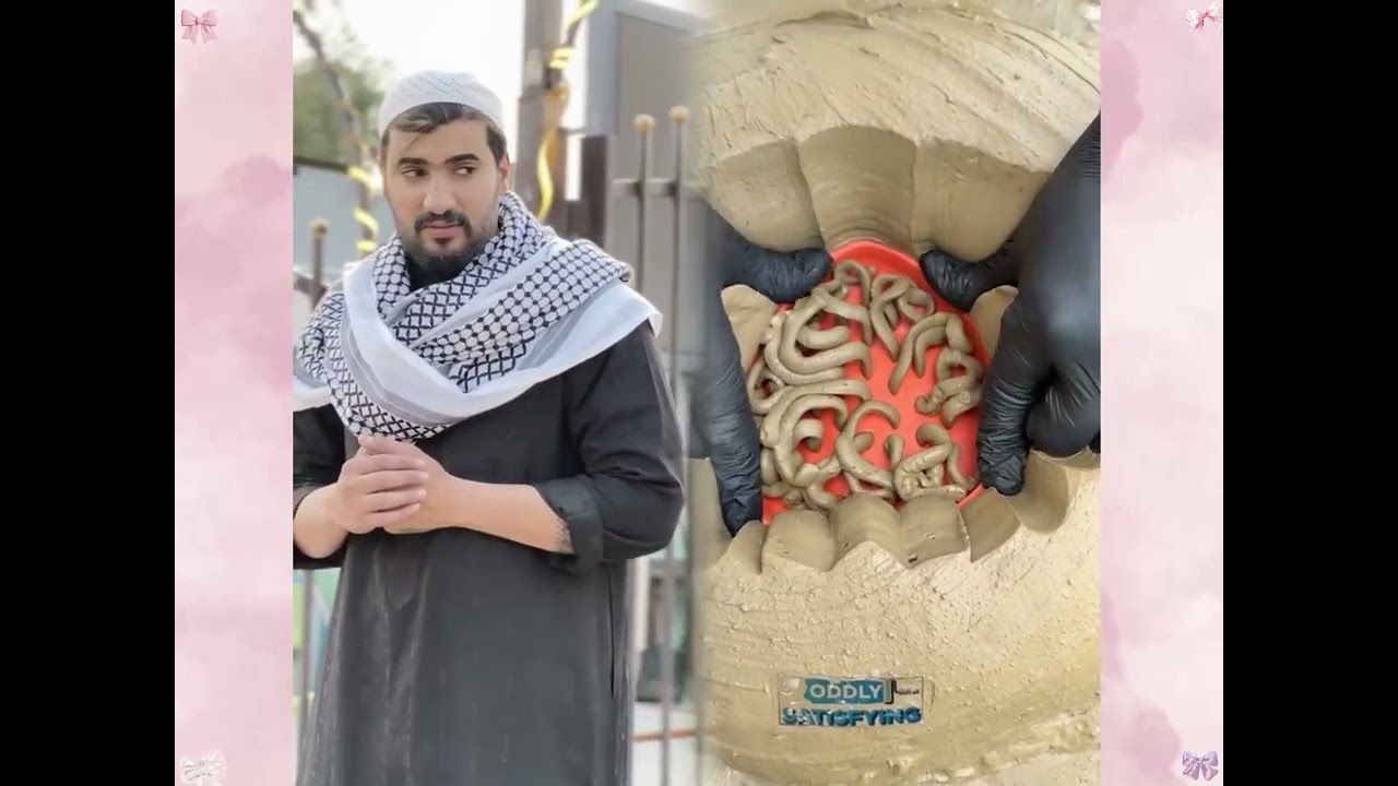 #الطفل الاعمى المعجزه #محضوره_من_الاكسبلور_والمشاهدات #علاوي_مارتن #اكسبلور 15_w (4)
