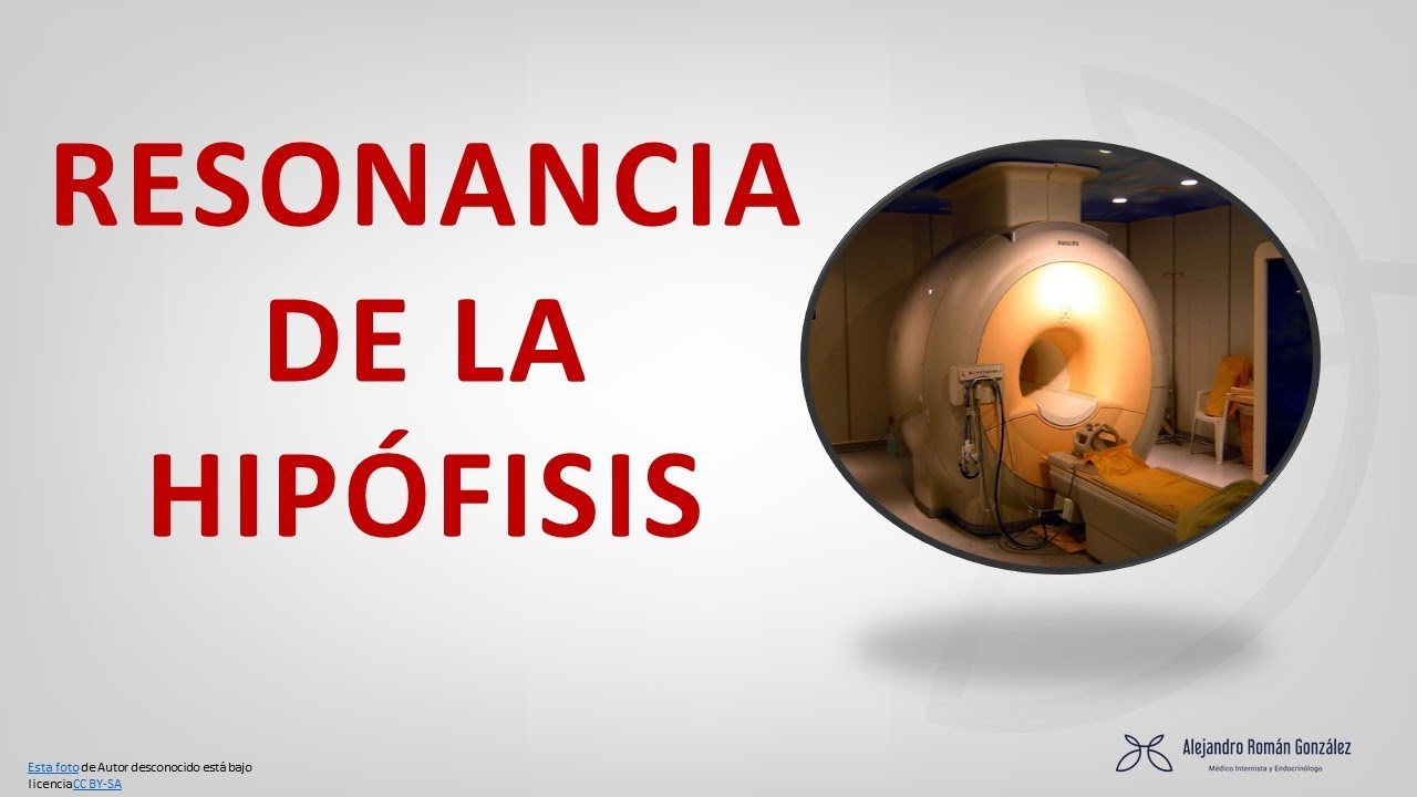 Qué se puede ver en una resonancia de la hipófisis/pituitaria  (prolactinoma, tumores, acromegalia.)