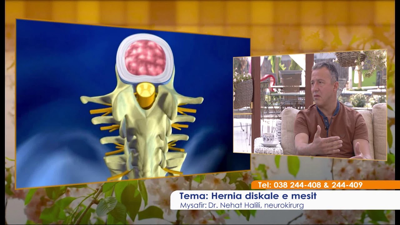 Mjeku ne studio - Dr.Nehat Halili, Neurokirurg 16.08.2017