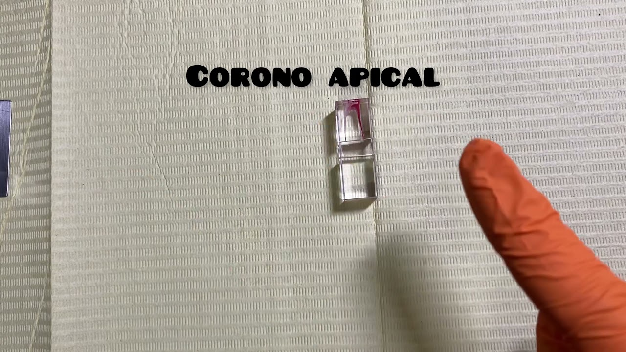 Técnica corono apical