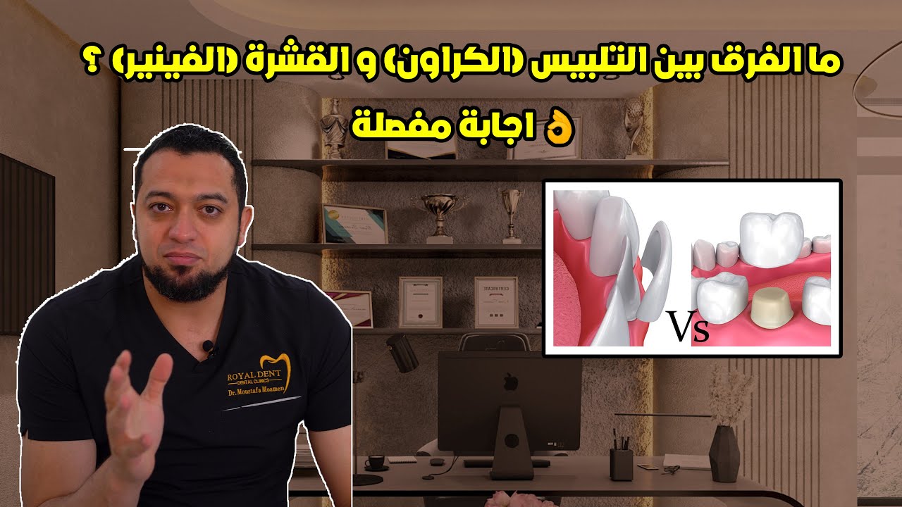 ما الفرق بين التلبيس (الكراون) و القشرة (الفينير) ؟ اجابة مفصلة 👌
