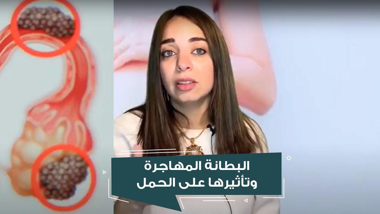 البطانة المهاجرة وتأثيرها على الحمل