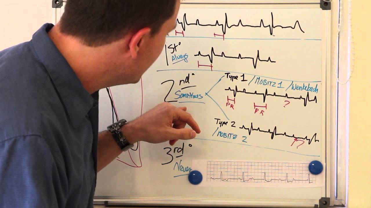 Easy Heart Blocks.mpg