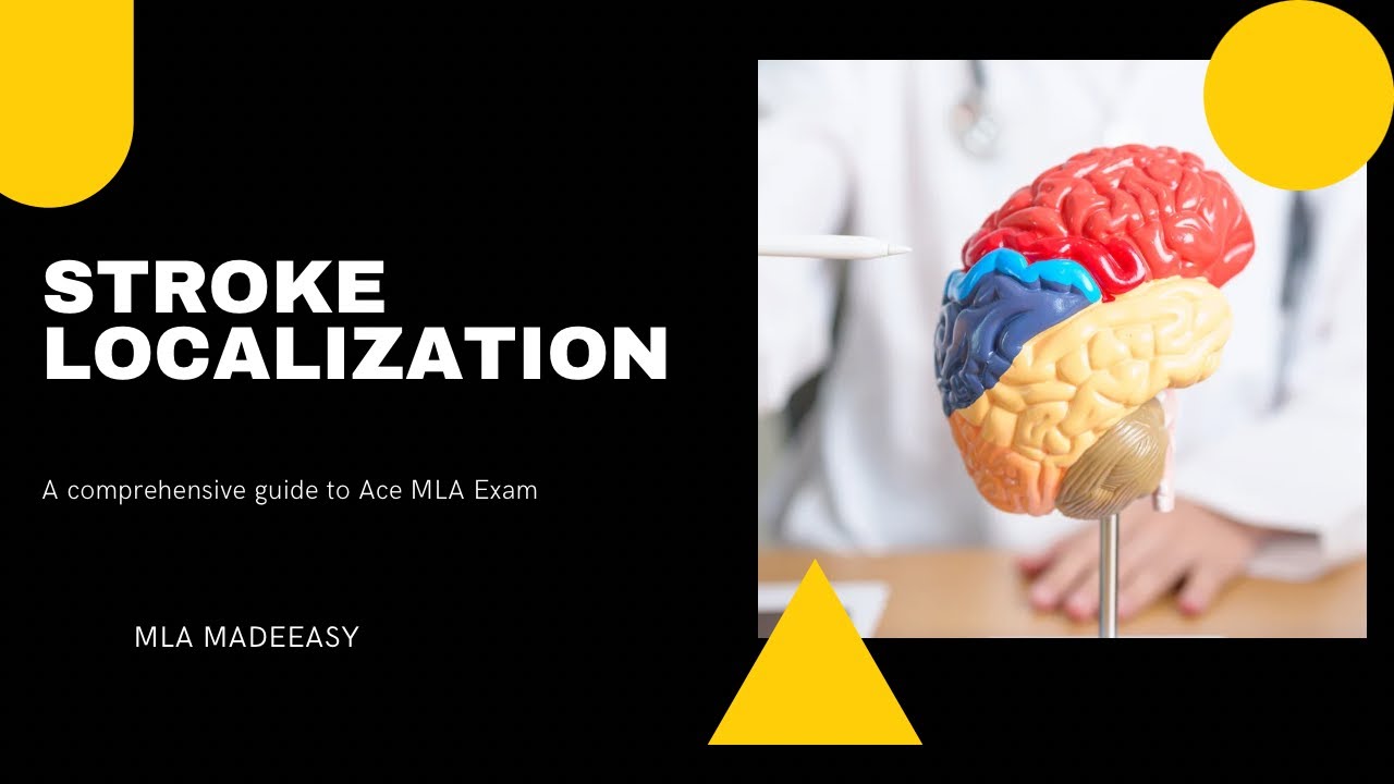 Stroke Localization