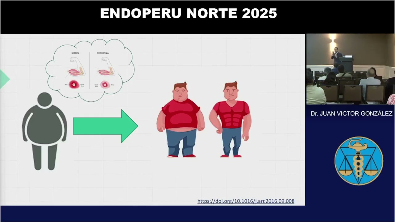 ENDOPERU NORTE - Dr. Juan González | Estrategias modernas en el manejo de la obesidad sarcopénica