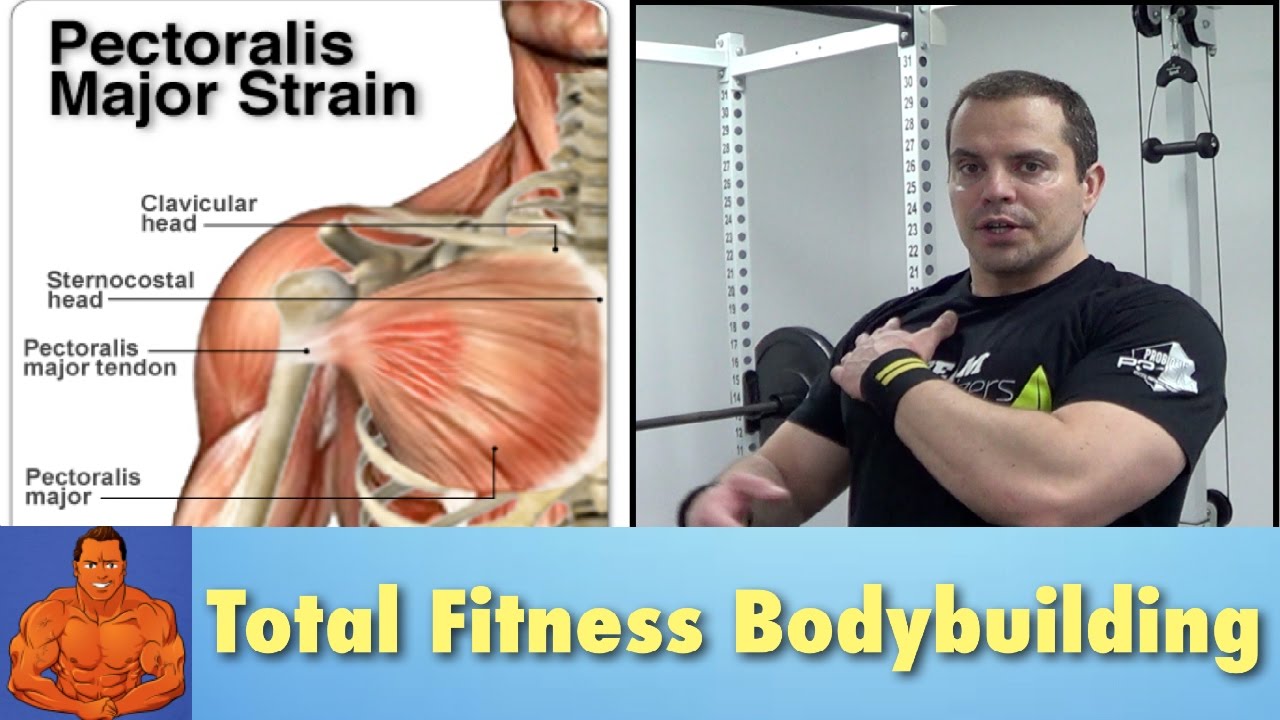 Pulled Chest Muscle - rehab exercises to speed recovery