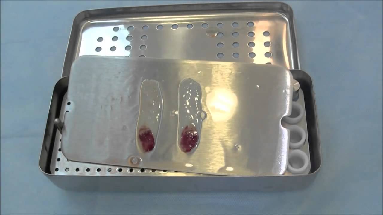 Получение мембран Clot-PRF (APRF) в специальном боксе