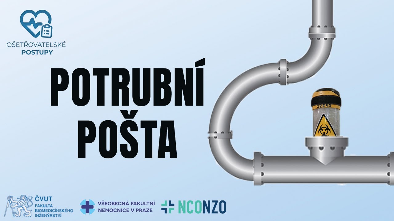 🇨🇿 (CZ) | POTRUBNÍ POŠTA | OŠETŘOVATELSKÉ POSTUPY
