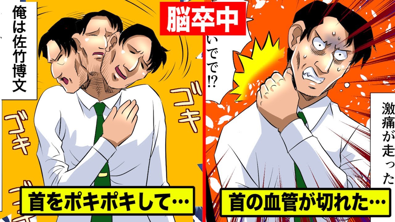 【脳卒中】首をポキポキして緊急手術に&hellip;血管が切れるリスク。