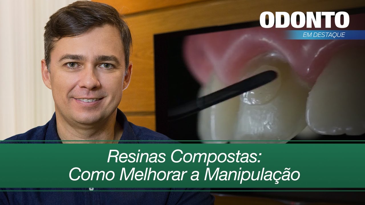 Resinas Compostas: Como Melhorar a Manipula&ccedil;&atilde;o |  Leonardo Muniz