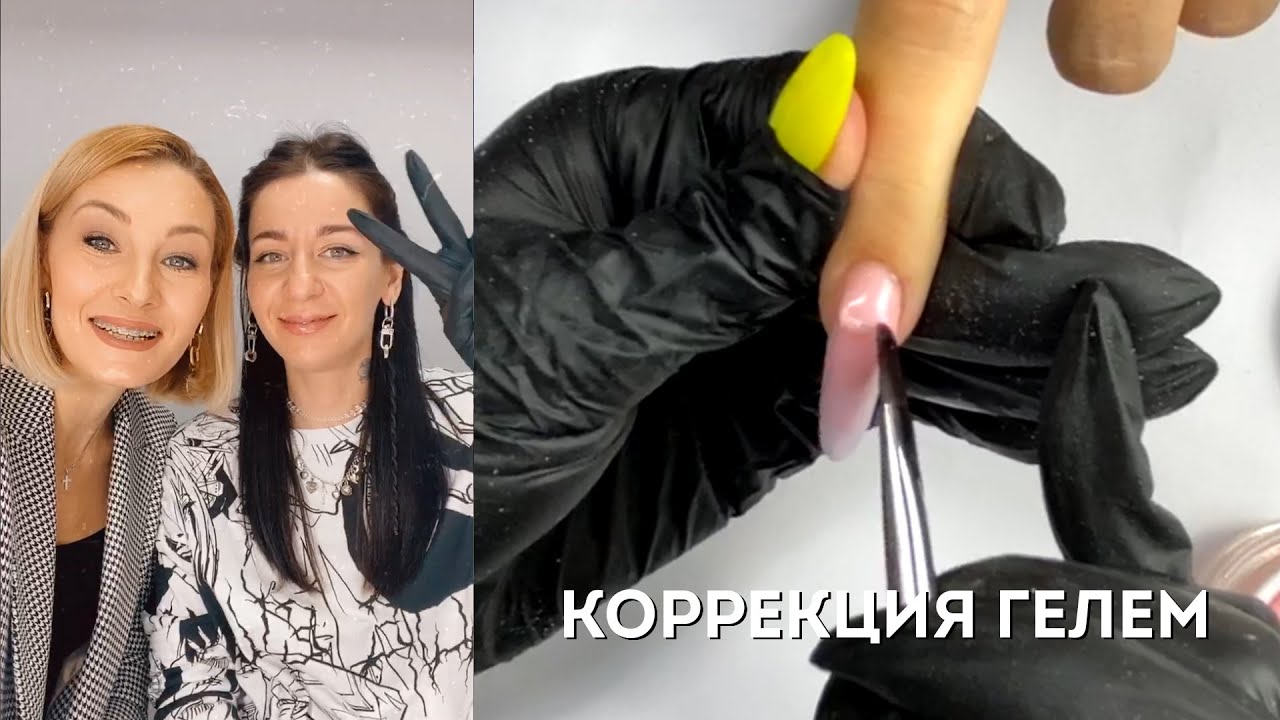 Коррекция гелем