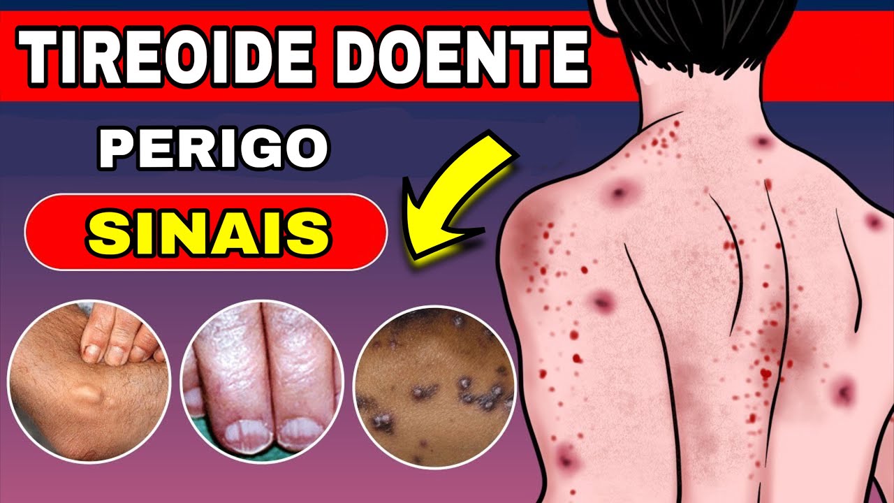 9 Sinais no Seu Corpo que Sua TIREOIDE Dá Antes de Morrer + 5 Fatos Científicos Que Ninguém Fala