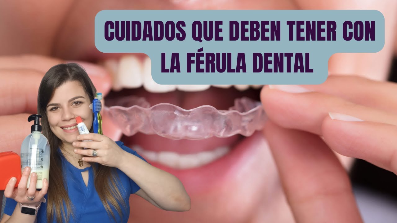 Como CUIDAR la FERULA DENTAL con 5 tips 🦷🏆