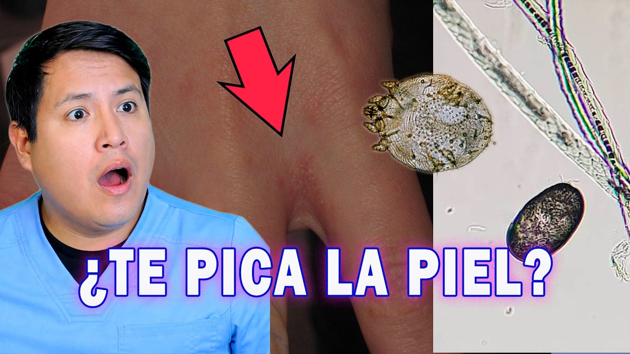 TE PICA LA PIEL - PODRÍA SER ESTO