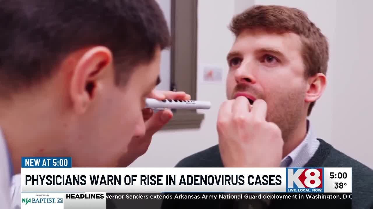 Adenovirus among many viruses spreading around Arkansas