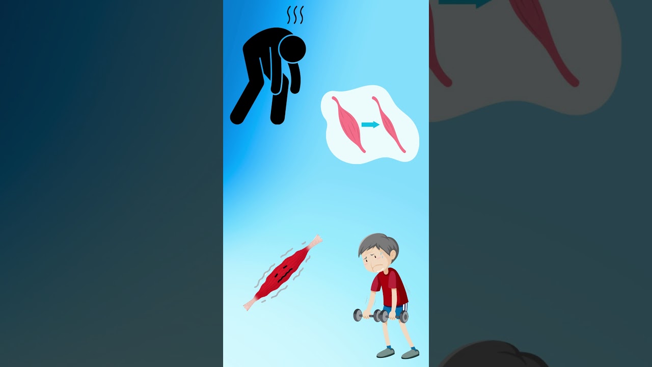 Lordosis Explained in 30 Seconds! #PhysioTips