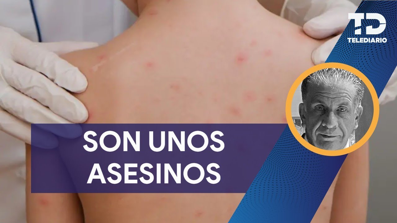 ¡Los antivacunas son unos imbéciles!, suben los casos de sarampión en Jalisco