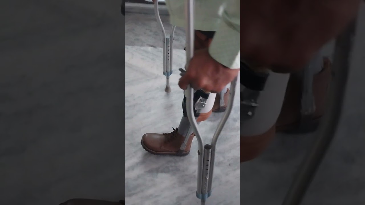 Bilateral Polio Disabled walking with traditional metal/leather Kafo Calipers #kafo #calipers #polio
