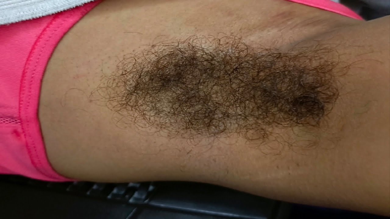 extreme hairy growth armpit shaving by straight razor @Rajlaxmi vlogs♥️
