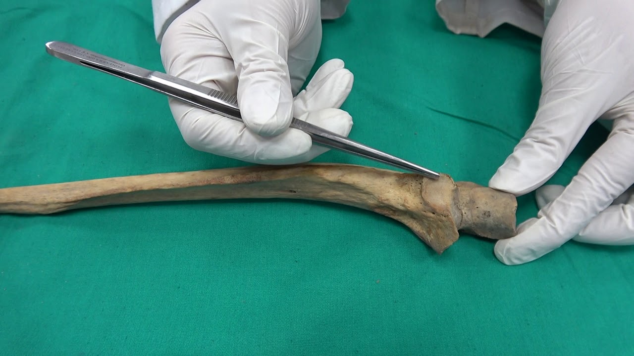 Anatomi Kemikler-Üst Ekstremite Kemikleri- Os Ulna Anatomisi (kemikler anatomi)