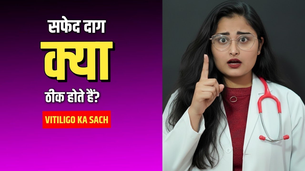 सफेद दाग (Vitiligo) क्यों होते हैं? क्या ये बीमारी सच में ठीक हो सकती है? By Dr. Sarhana