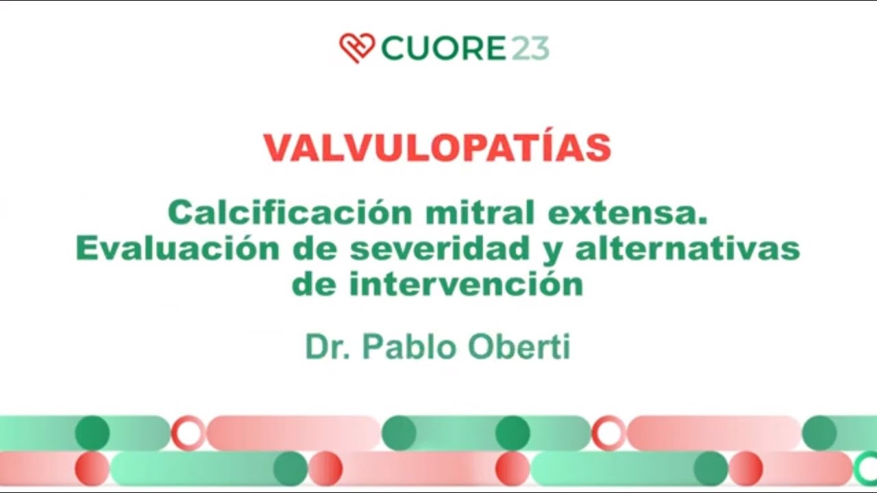 Valvulopatias Calcificación mitral extensa
