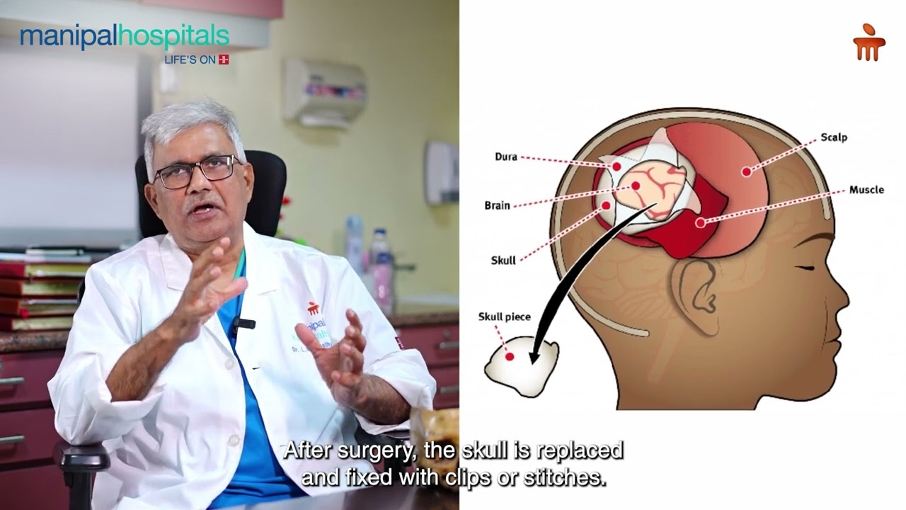 What Is Craniotomy? | Dr. LN Tripathy | Manipal Hospital EM Bypass