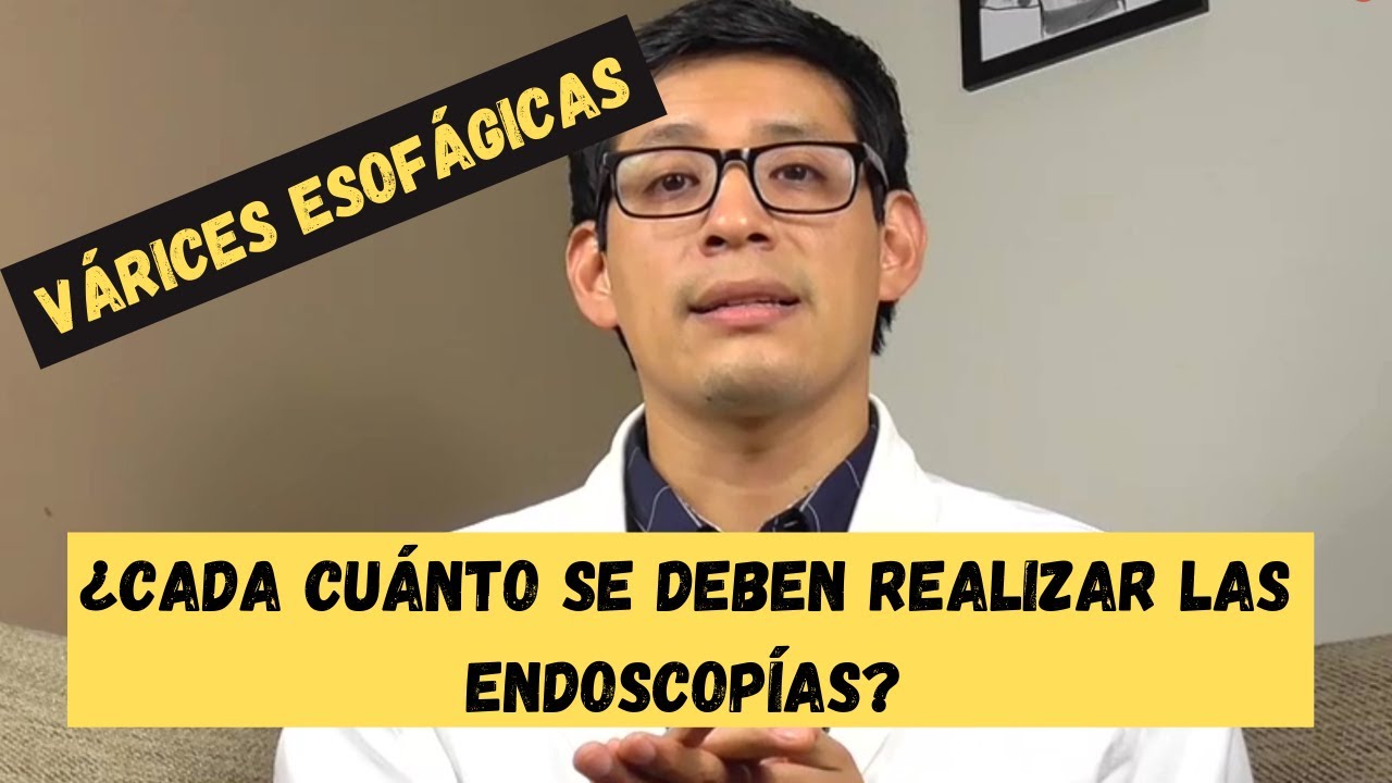 V&aacute;rices esof&aacute;gicas endoscop&iacute;a