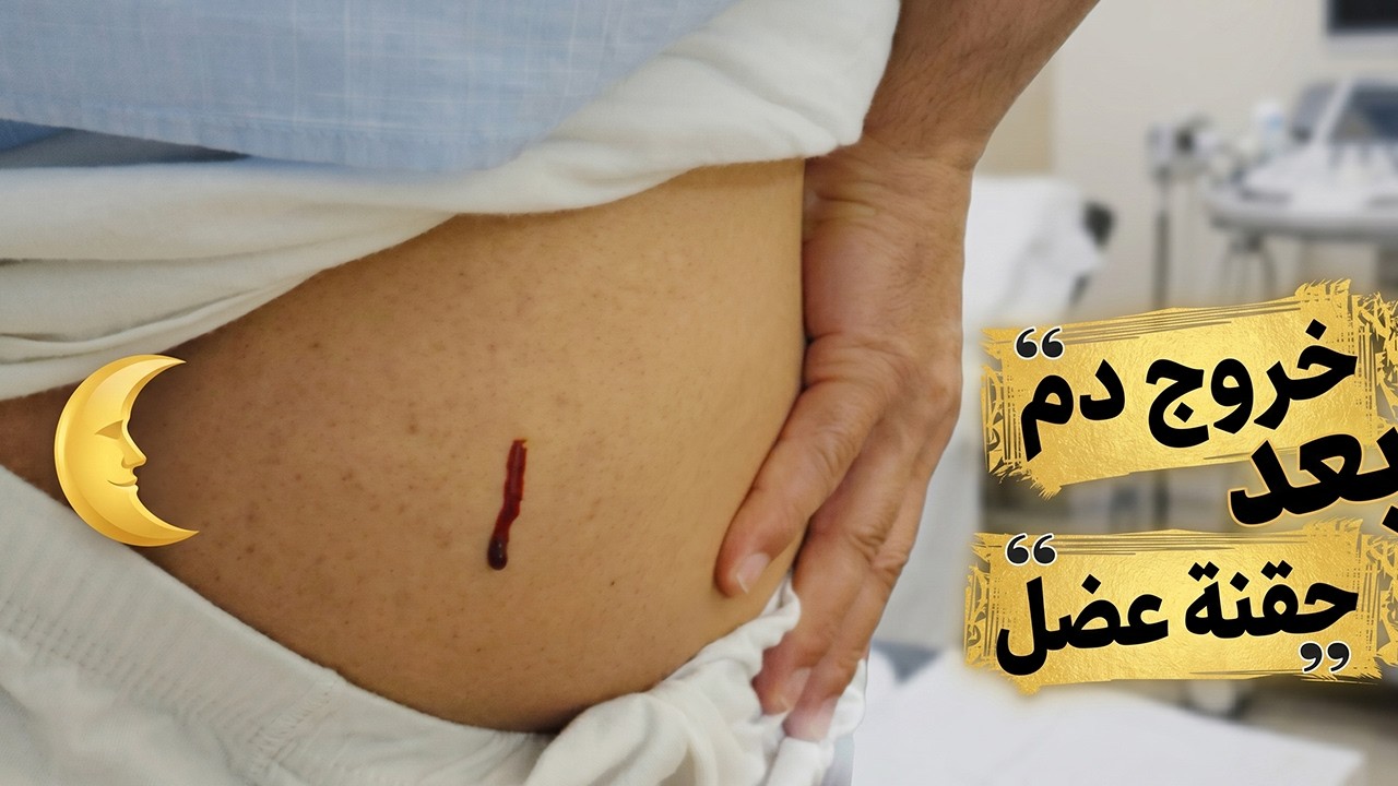 خروج دم بعد ابر حقنة عضل لاشخاص عنيفة جدا  | السبب الحقيقى وراء خروج الدم بعد الحقن العضلى