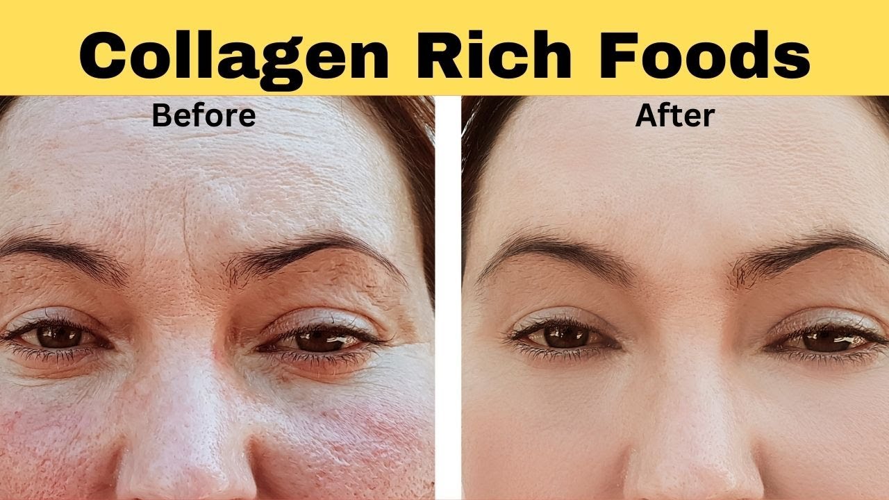 Nourish to Flourish: Top 10 Collagen-Rich Foods l Nutrition Guru