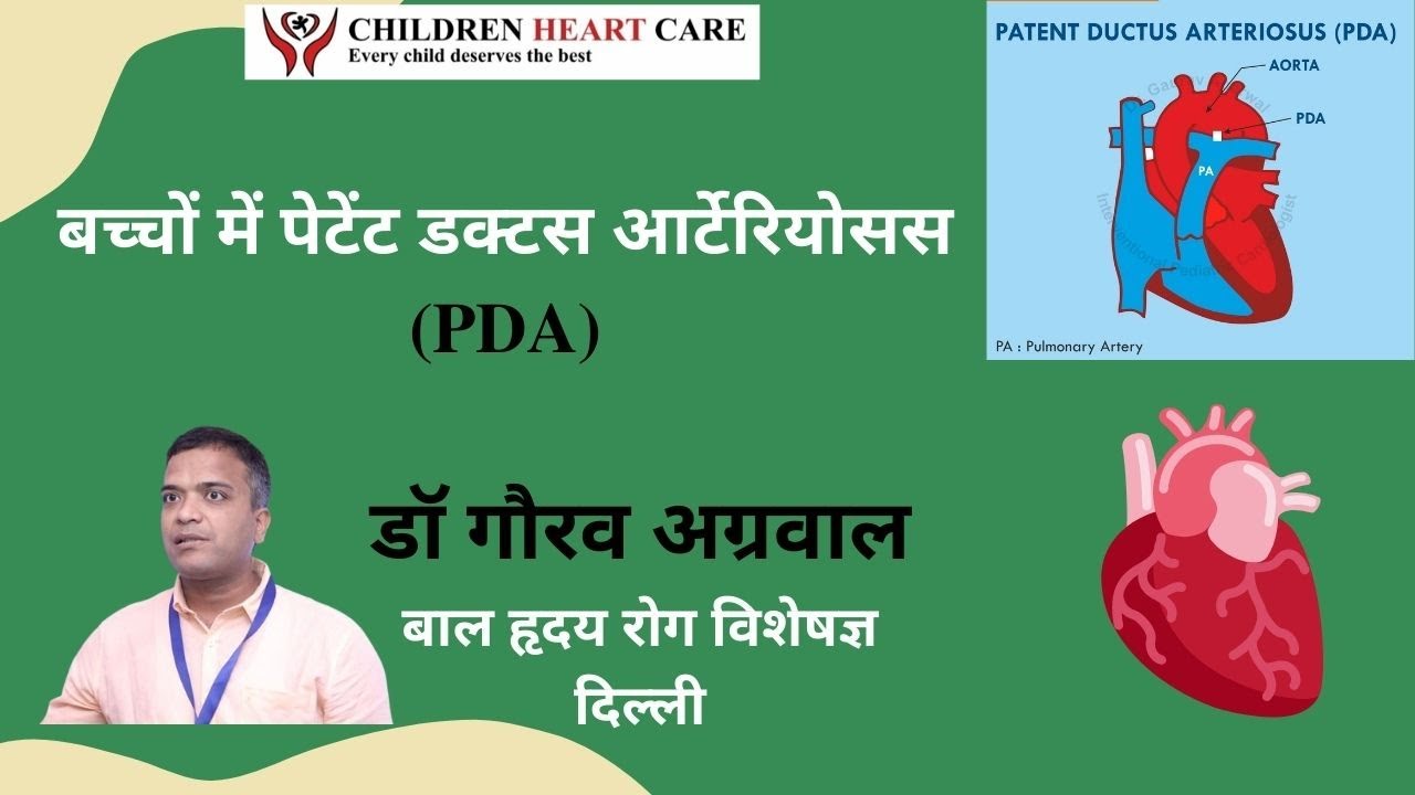 Patent Ductus Arteriosus in Hindi, PDA, pda heart defect: डॉ गौरव अग्रवाल