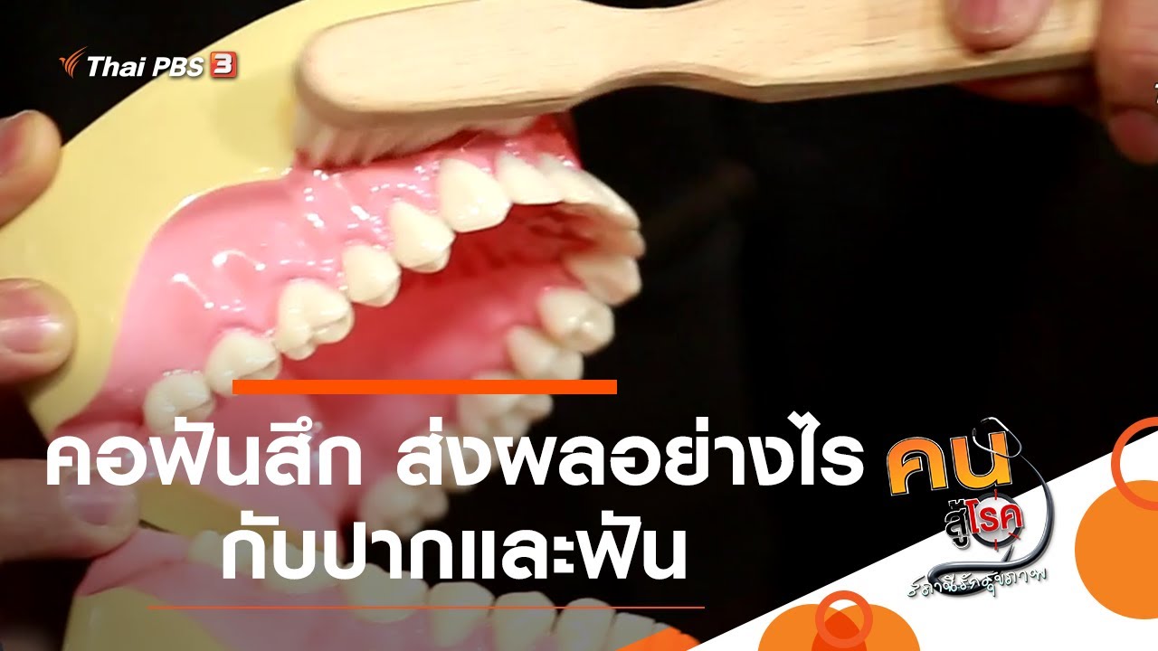 คอฟันสึก ส่งผลอย่างไรกับปากและฟัน : รู้สู้โรค (10 มี.ค. 64)