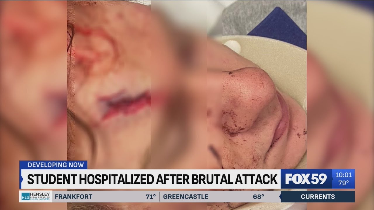 Family demands action after &lsquo;brutal attack&rsquo; at Perry Meridian High School leaves student hospitalize