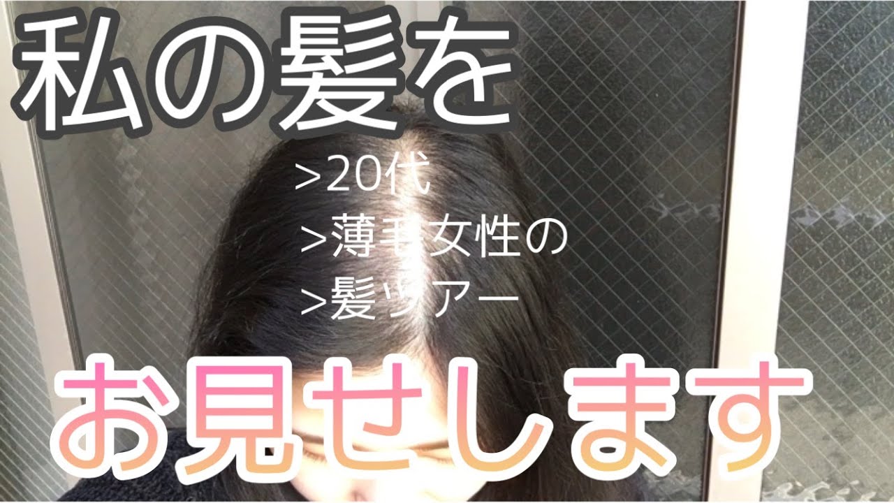 【髪ツアー】２０代薄毛女性の現状【2020AW】
