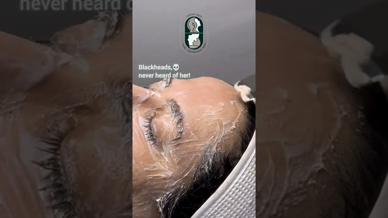 Удаление омертвевшей кожи, часть 1