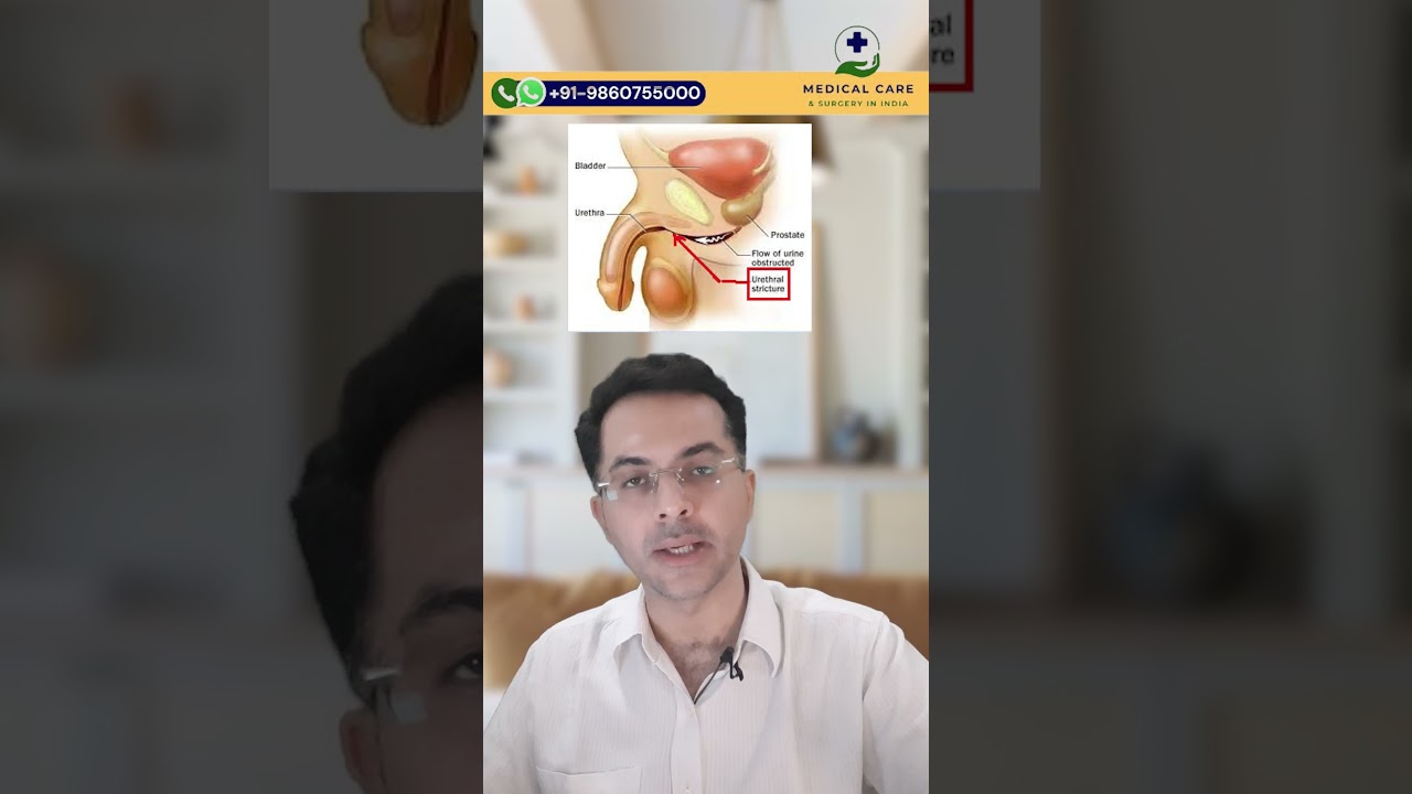 🔍 What is Urethroplasty Surgery? Your Guide to Treatment in India!