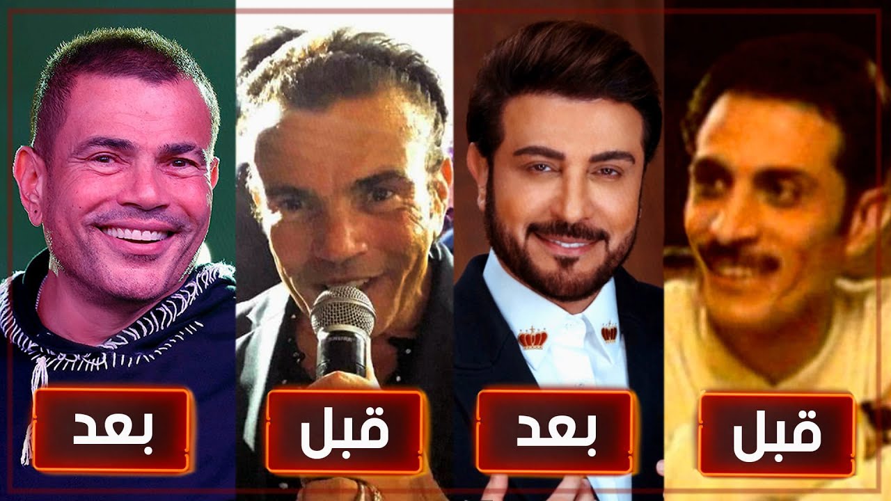 اشهر 10 فنانين رجال خضعو لعمليات التجميل !!