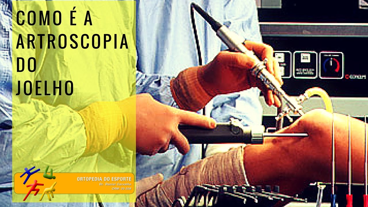 Como é a artroscopia do joelho