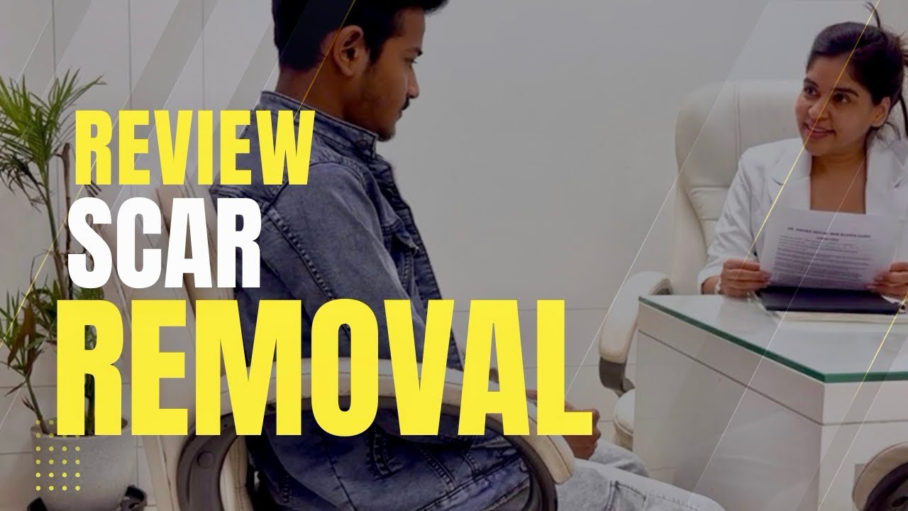 How to remove scar on face | real results of scar removal | scar removal before after 