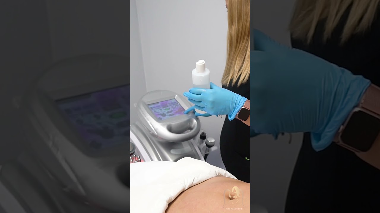 Laser & Skin Clinic - Tratamientos Corporales