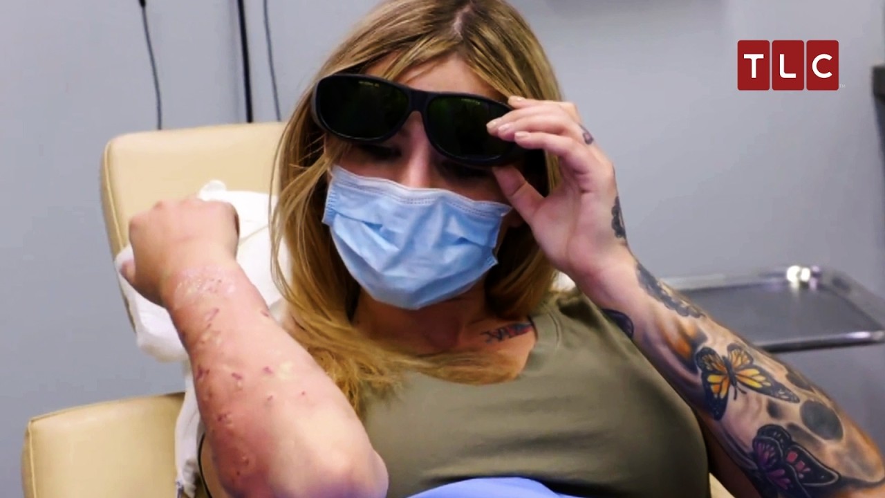 A Patient&rsquo;s Final Hope in Dr. Lee&rsquo;s Hands! | Dr Pimple Popper TLC