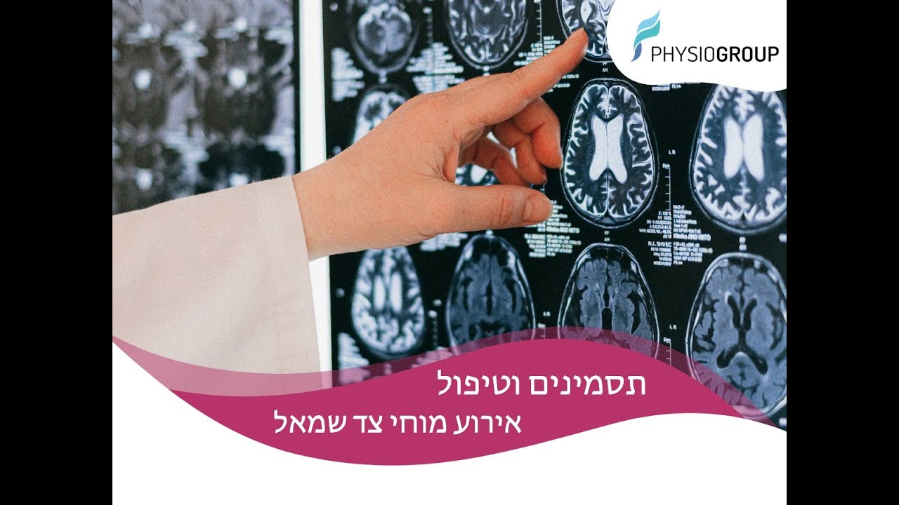מה שונה באירוע מוחי בצד שמאל?