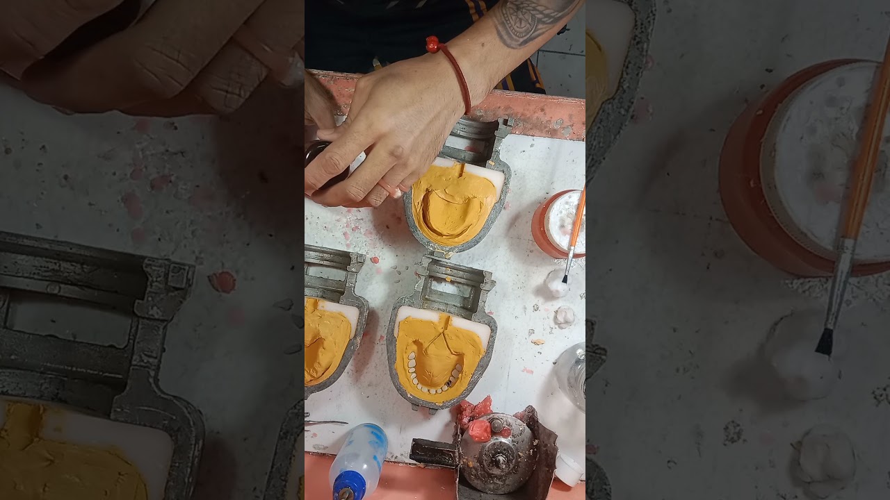 how to make IVOCAP DENTURE.