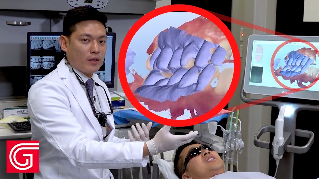 Cómo capturar de manera correcta el registro de mordida de forma intraoral