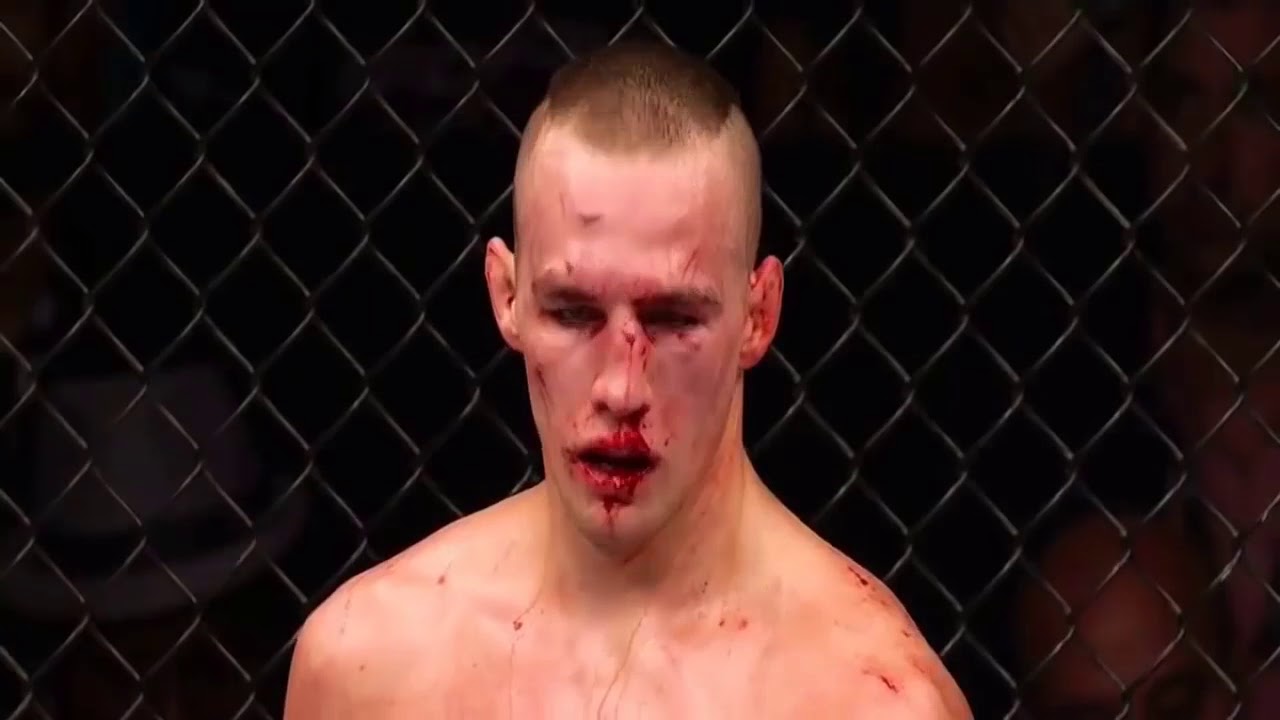 Robbie Lawler vs Rory Macdonald 2 - Sweet Dreams